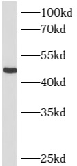 ST6GAL1 antibody|ST6GAL1抗体 FNa