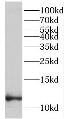 LCE1B antibody|LCE1B抗体
