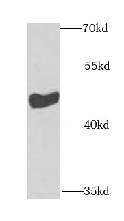 INPP5K antibody|INPP5K抗体