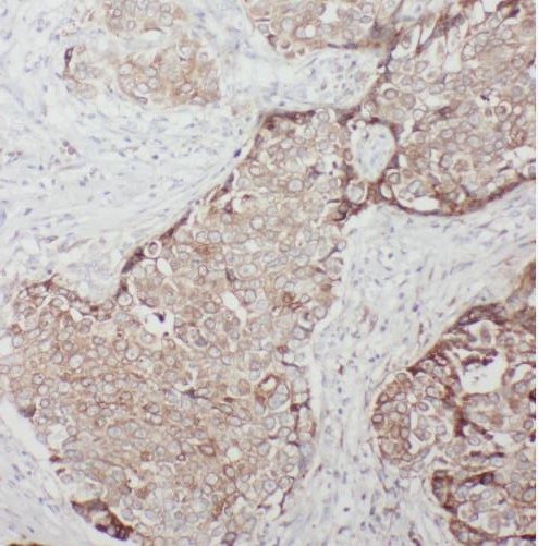 TBC1D17 antibody|TBC1D17抗体