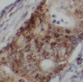 PTCH1 antibody|PTCH1抗体 FNab100