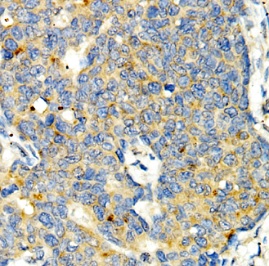 MTOR antibody|MTOR抗体 FNab11071