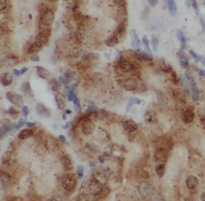 PDGFRB antibody|PDGFRB抗体 FNab0