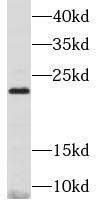 MMP26 antibody|MMP26抗体
