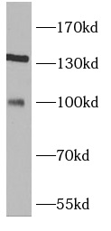 TRIM37 antibody|TRIM37抗体
