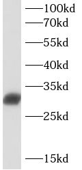 HLA-DMA antibody|HLA-DMA抗体