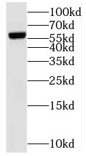 MSL3 antibody|MSL3抗体
