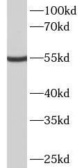 METTL4 antibody|METTL4抗体