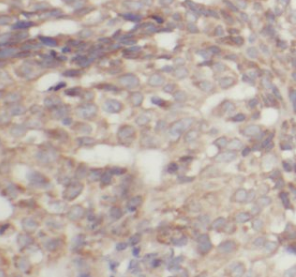 IMP3 antibody|IMP3抗体 FNab04297