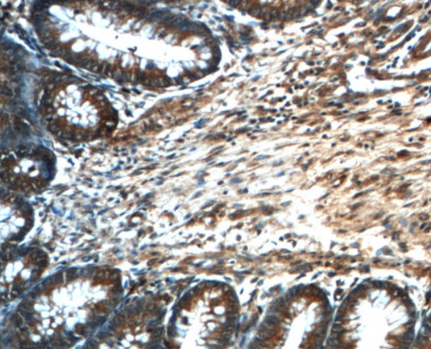 PRDX4 antibody|PRDX4抗体 FNab067