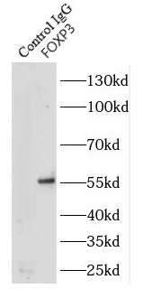 ESRRB antibody|ESRRB抗体