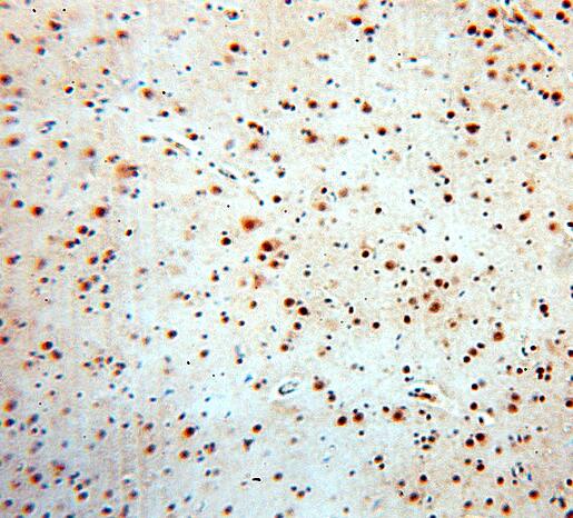 SRF antibody|SRF抗体