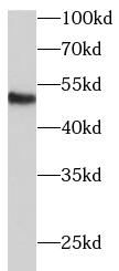 ECM1 antibody|ECM1抗体