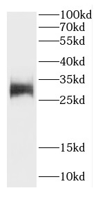 CA13 antibody|CA13抗体