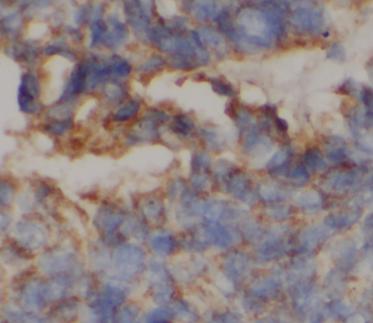 CPN1 antibody|CPN1抗体 FNab09983