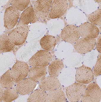 ENO3 antibody|ENO3抗体 FNab02767