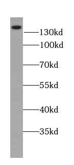 ATP2B2 antibody|ATP2B2抗体