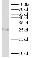 PSMB7 antibody|PSMB7抗体