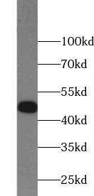 RUVBL1 antibody|RUVBL1抗体