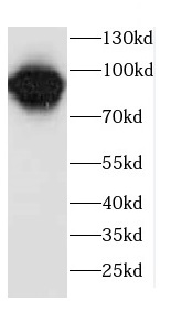 CCPG1 antibody|CCPG1抗体