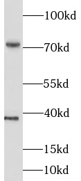 LIMK1 antibody|LIMK1抗体