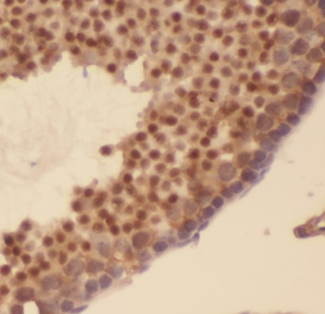 AKAP3 antibody|AKAP3抗体 FNab002