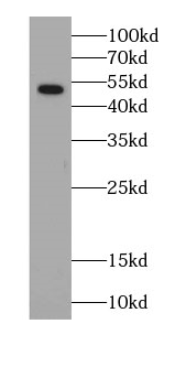 SLC17A1 antibody|SLC17A1抗体