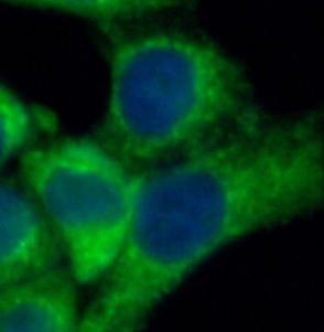 KRT18 antibody|KRT18抗体 FNab022