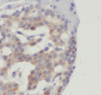ETF1 antibody|ETF1抗体