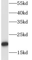 RPL18A antibody|RPL18A抗体 FNab0