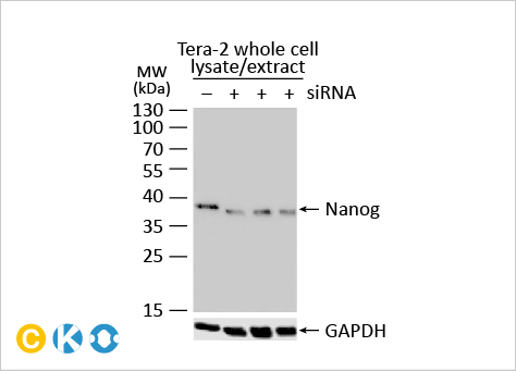 文献速递：细胞外基质硬化与睾丸老化及睾酮水平下降相关