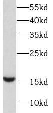 BIRC5 antibody|BIRC5抗体 FNab099