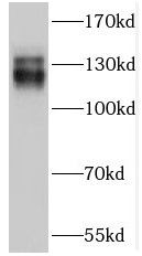 TRAPPC9 antibody|TRAPPC9抗体 FNa