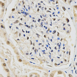 SNRPE antibody|SNRPE抗体