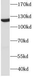 DDB1 antibody|DDB1抗体 FNab02285