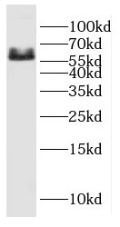 CYP26B1 antibody|CYP26B1抗体