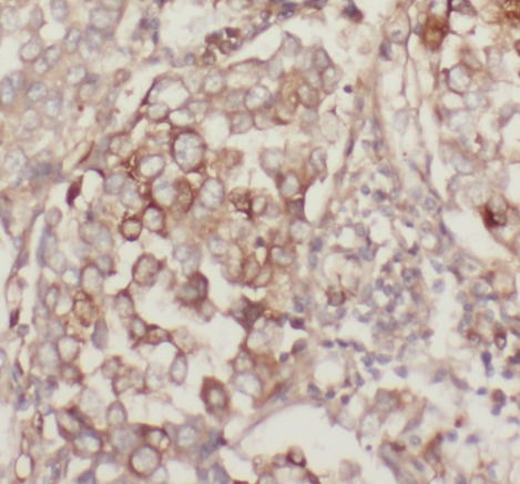 MUC1 antibody|MUC1抗体 FNab05427
