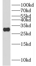 HOXC4 antibody|HOXC4抗体