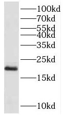 PPP3R2 antibody|PPP3R2抗体