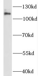 PTK2B antibody|PTK2B抗体 FNab069