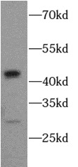 CASP1 antibody|CASP1抗体 FNab012
