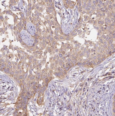 BET1L antibody|BET1L抗体