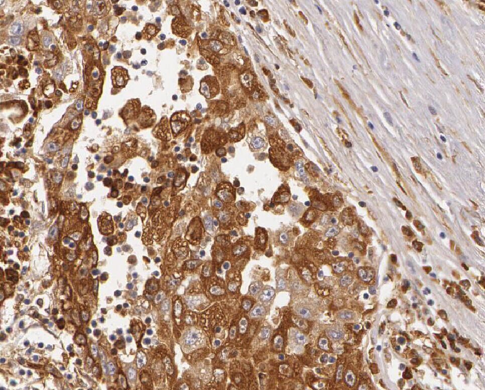 ZNF622 antibody|ZNF622抗体