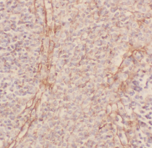 CD33 antibody|CD33抗体