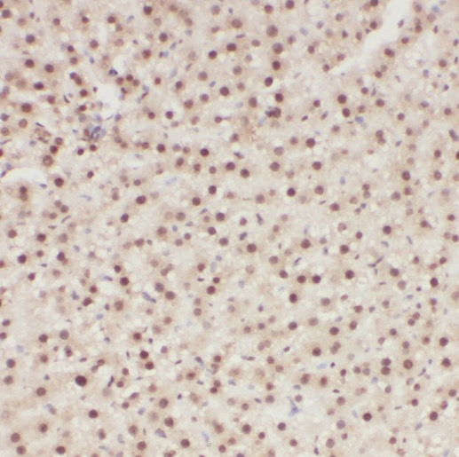 PI4K2B antibody|PI4K2B抗体