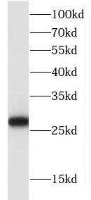 FKBP14 antibody|FKBP14抗体