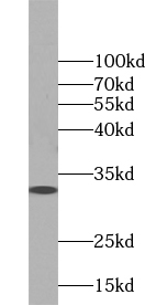 TSPAN13 antibody|TSPAN13抗体