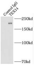 STAM2 antibody|STAM2抗体