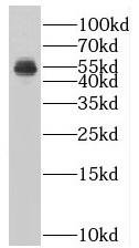 SUV39H1 antibody|SUV39H1抗体