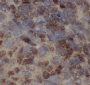 PLOD2-Specific antibody|PLOD2抗